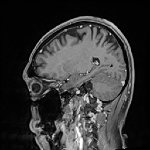 Click on the Serie image to view the images of VILLANUEVA, WILLIAM A.